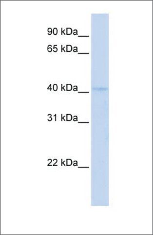 Anti-RAD9A antibody produced in rabbit