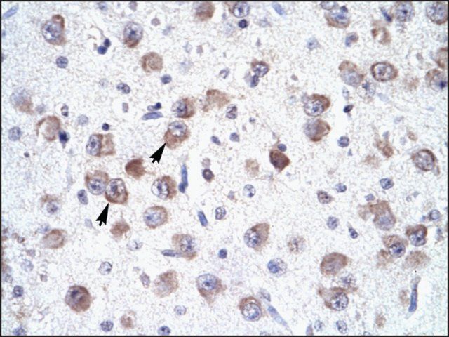 Anti-RALY antibody produced in rabbit
