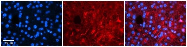 Anti-RARA antibody produced in rabbit
