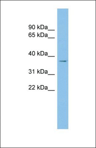 Anti-RALY antibody produced in rabbit