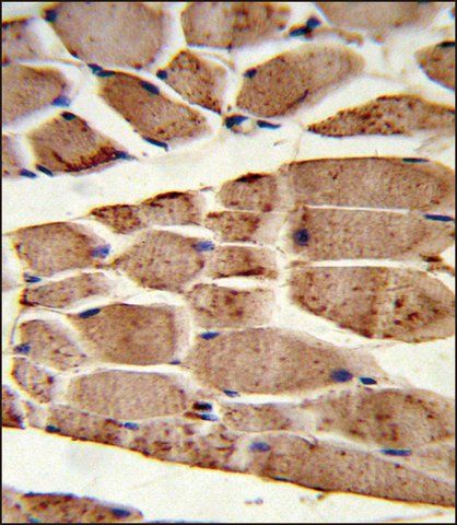 ANTI-RANBP9 (CENTER) antibody produced in rabbit