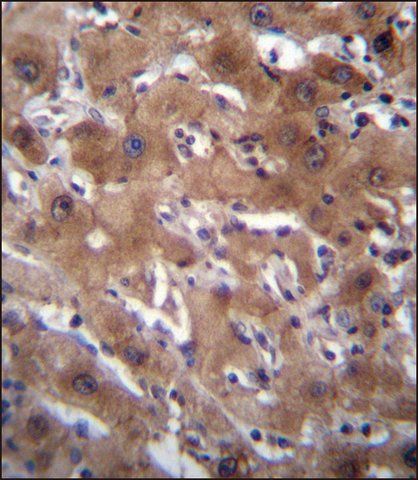 ANTI-RASSF10 (CENTER) antibody produced in rabbit