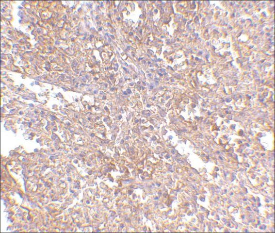 Anti-RAP80 (ab1) antibody produced in rabbit