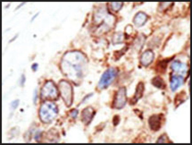 Anti-RANBP2 (C-term) antibody produced in rabbit