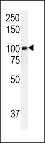 ANTI-RASGRP1 (CENTER) antibody produced in rabbit