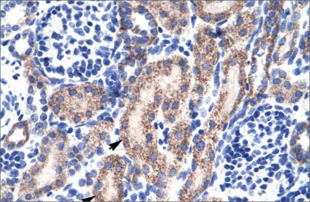 Anti-RBAK antibody produced in rabbit