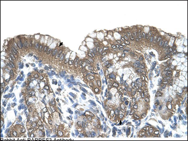 Anti-RARRES3 antibody produced in rabbit