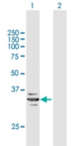 Anti-RARRES1 antibody produced in mouse