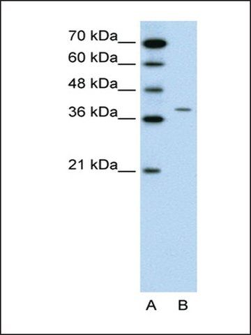 Anti-RAPSN antibody produced in rabbit