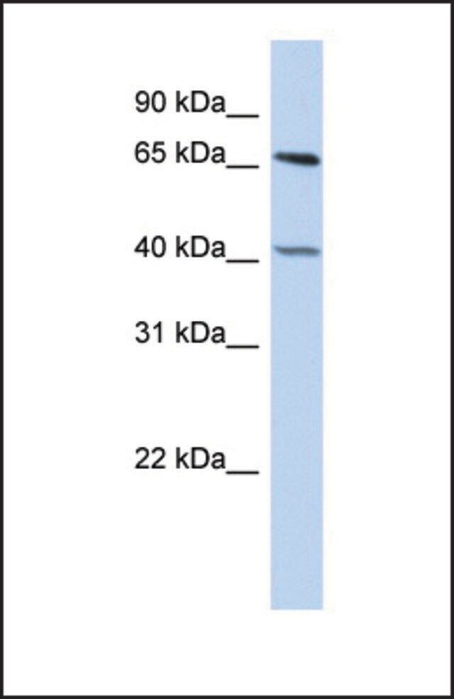Anti-RBBP5 antibody produced in rabbit