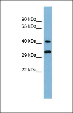 Anti-RBJ antibody produced in rabbit