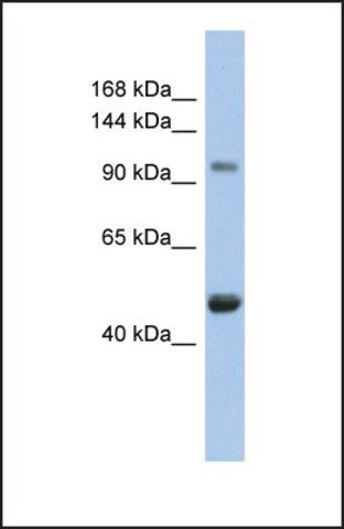 Anti-RBL1 antibody produced in rabbit
