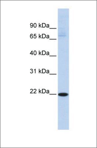 Anti-RBPMS2 (ab2) antibody produced in rabbit