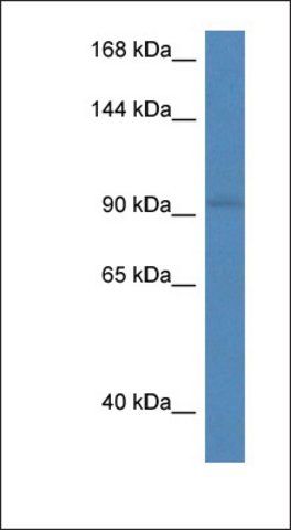 Anti-RECK antibody produced in rabbit