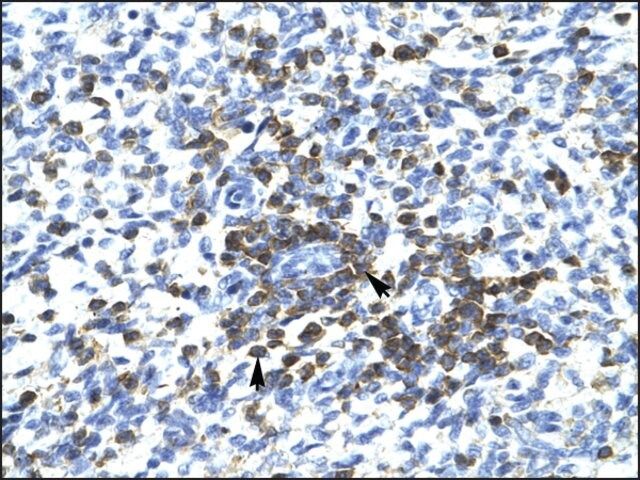 Anti-RCOR3 antibody produced in rabbit