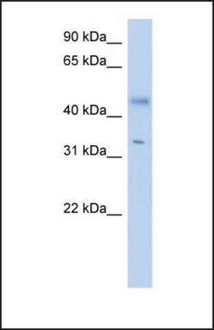 Anti-RDHE2 antibody produced in rabbit