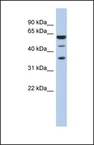 Anti-RDBP, (N-terminal) antibody produced in rabbit
