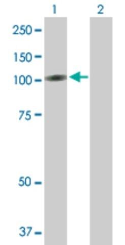 Anti-RECK antibody produced in mouse