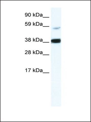 Anti-RELB (AB1) antibody produced in rabbit