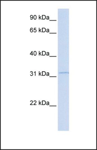 Anti-RDH12 antibody produced in rabbit