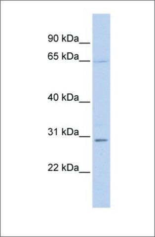 Anti-REL (ab2) antibody produced in rabbit