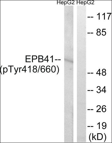 Anti-phospho-EPB41 (pTyr<sup>660/418</sup>) antibody produced in rabbit
