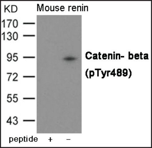 Anti-phospho-Catenin-β (pTyr<sup>489</sup>) antibody produced in rabbit