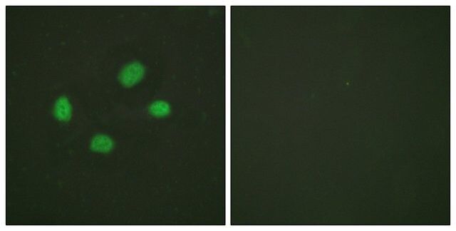 Anti-phospho-Chk2 (pThr<sup>383</sup>) antibody produced in rabbit