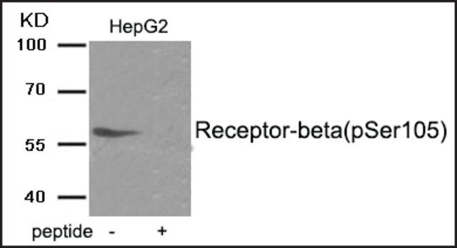 Anti-phospho-Estrogen Receptor-β (pSer<sup>105</sup>) antibody produced in rabbit