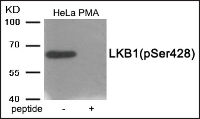 Anti-phospho-LKB1 (pSer<sup>428</sup>) antibody produced in rabbit