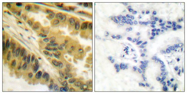 Anti-PKC ζ antibody produced in rabbit