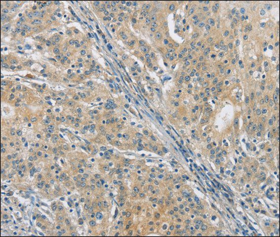 Anti-PKD1 antibody produced in rabbit
