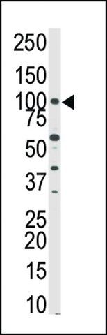 ANTI-PKN BETA(C-TERMINAL) antibody produced in rabbit