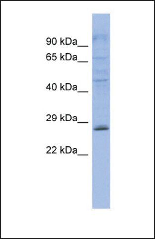 Anti-PLEKHB2 antibody produced in rabbit