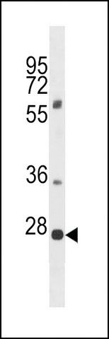 ANTI-PLEKHF1(N-TERMINAL) antibody produced in rabbit