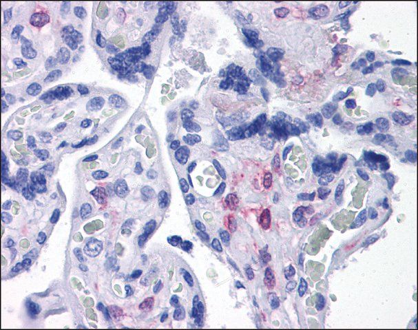 Anti-PLAC1 antibody produced in rabbit