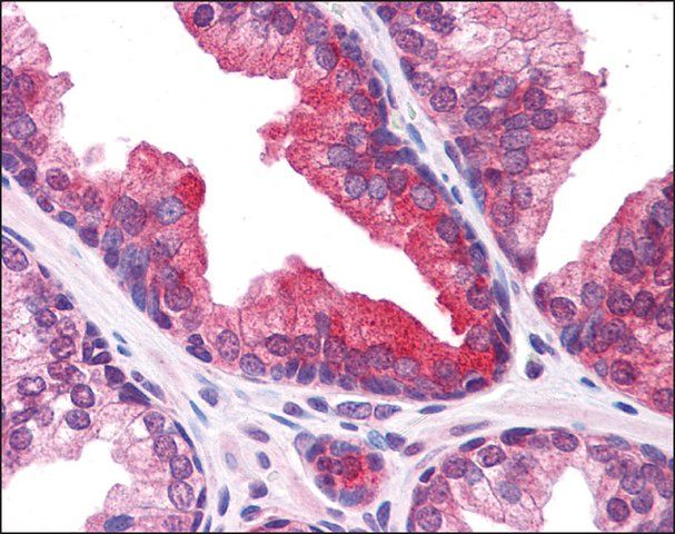 Anti-PLEKHM3 antibody produced in rabbit