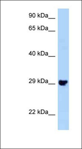 Anti-PLEKHF2 antibody produced in rabbit