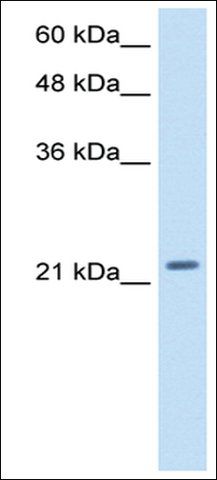 Anti-PMF1 antibody produced in rabbit