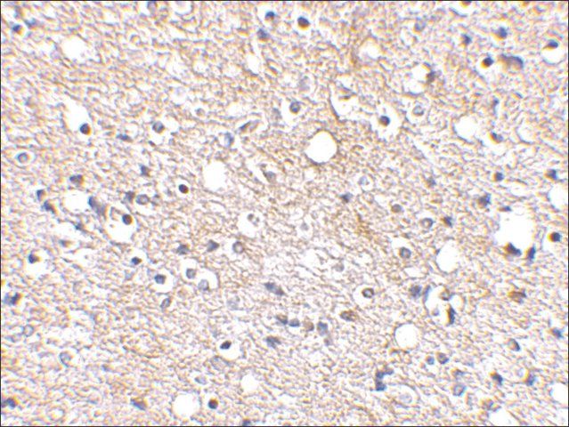 Anti-Plxdc2 (ab1) antibody produced in rabbit