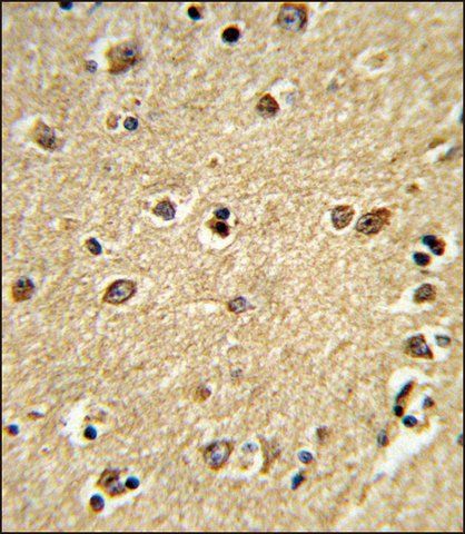 ANTI-PLCB2 (N-TERM) antibody produced in rabbit