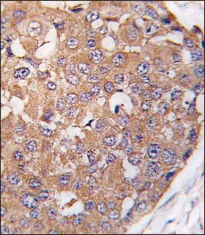 ANTI-PLK2 (SNK)(C-TERMINAL) antibody produced in rabbit