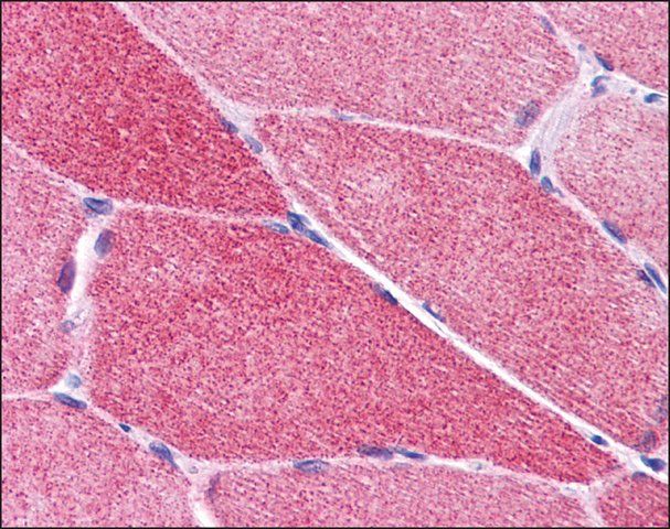 Anti-PLEKHM2 / SKIP antibody produced in rabbit