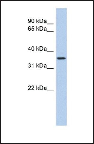 Anti-POLR3F, (N-terminal) antibody produced in rabbit