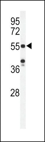 ANTI-POTEH(N-TERMINAL) antibody produced in rabbit