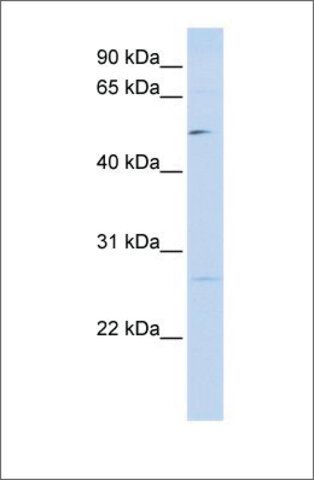 Anti-PPM1M antibody produced in rabbit