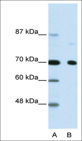 Anti-NCOR2 (AB2) antibody produced in rabbit