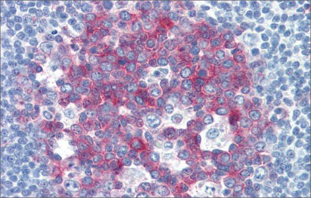 Anti-NCOA3 antibody produced in rabbit