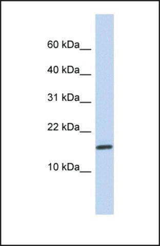 Anti-NCRNA00114, (N-terminal) antibody produced in rabbit