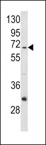 ANTI-ND5(C-TERMINAL) antibody produced in rabbit
